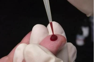 Análisis de sangre para detectar helmintos
