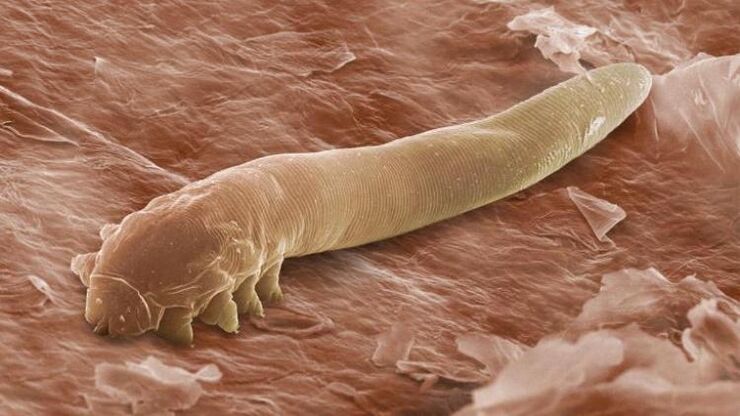 gusano que vive debajo de la piel humana
