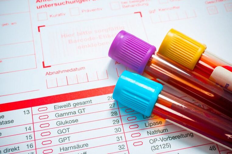 Sangre para la investigación sobre parásitos