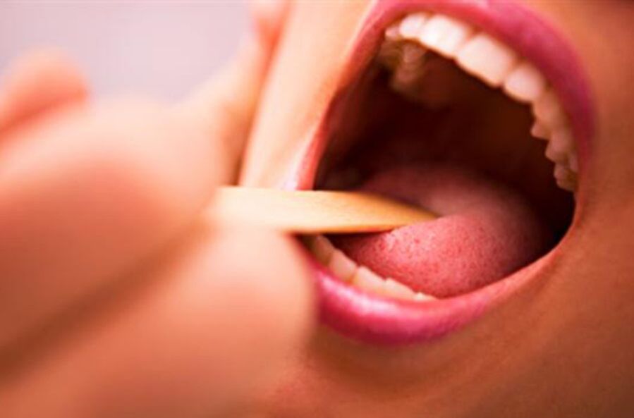 tipos de parásitos en la boca humana