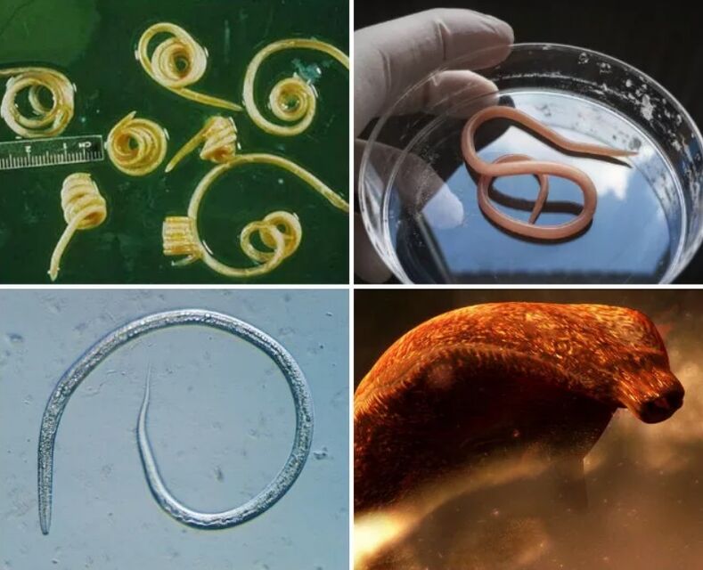 tipos de gusanos en el cuerpo humano